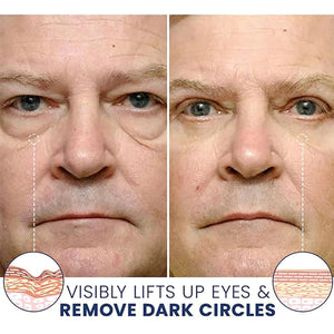Crema Reafirmante Para Ojos