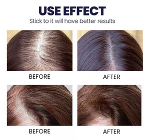 Folixis™ Crecimiento de Cabello De Manera Natural.